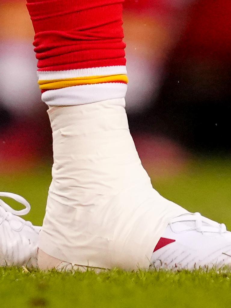 Mahomes: I had a 'cinder block on my leg' in playoffs