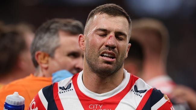 James Tedesco missed last week’s loss to the Storm under the NRL’s concussion protocols after he was hit high by Parramatta’s Bailey Simonsson. Picture; Mark Kolbe/Getty Images