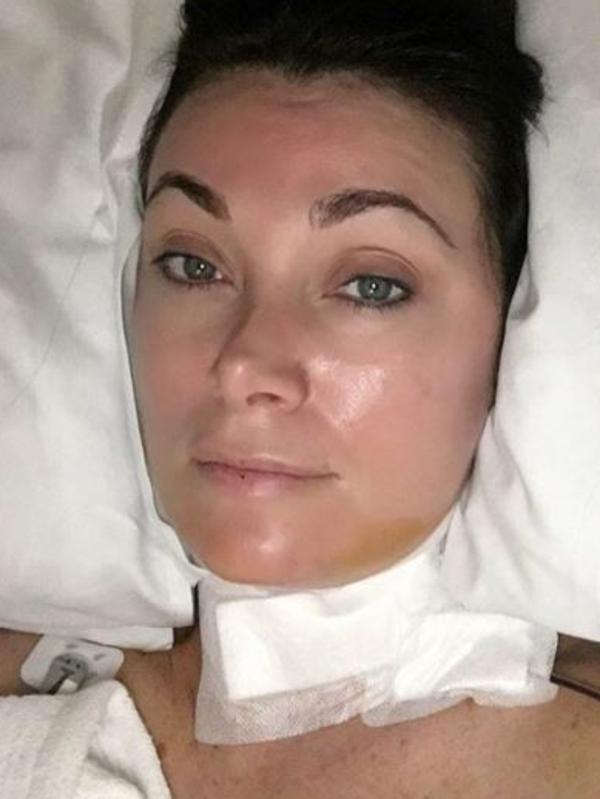 Lisa Oldfield in hospital after her neck op. Picture: Instagram