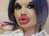 Woman’s extreme move to look like Bratz Doll