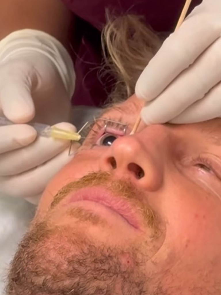 Rory Sloane details his eye surgery. Picture: Instagram