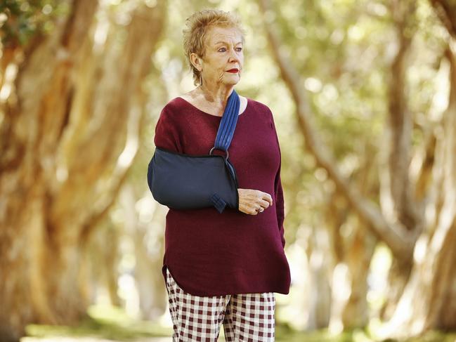 Liz was hit by a cyclist while crossing the road at Centennial Park during a dog walk with her hound Martha. Picture: Sam Ruttyn