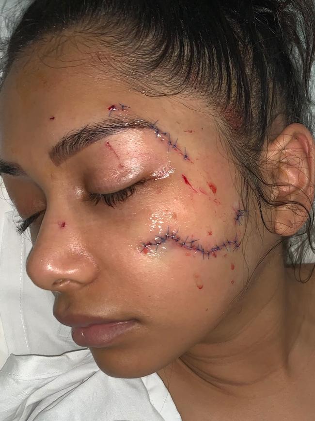 Delia Fernandez’s horrific injuries after surgery.