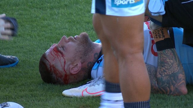 Josh Dugan left the field for Head Injury Assessment in his side's match against the Cowboys.