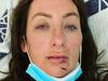 Gogglebox star’s horror Christmas injury