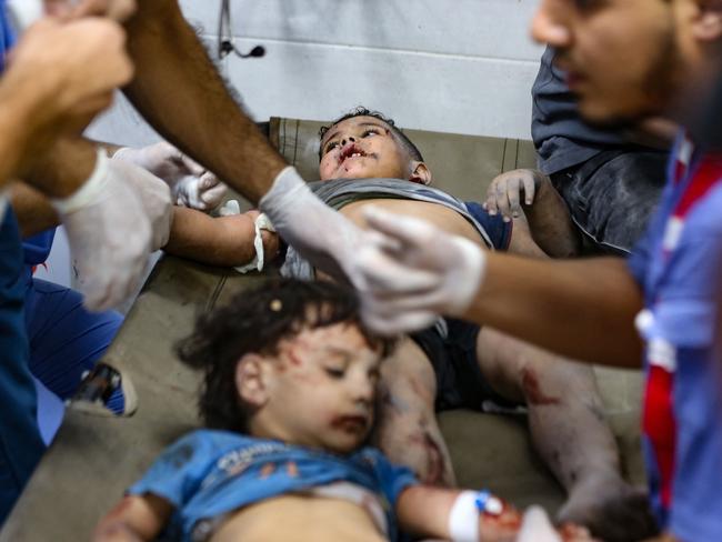 Children injured in an Israeli strike receive emergency medical care at the Al-Shifa hospital in Gaza City. Picture: AFP