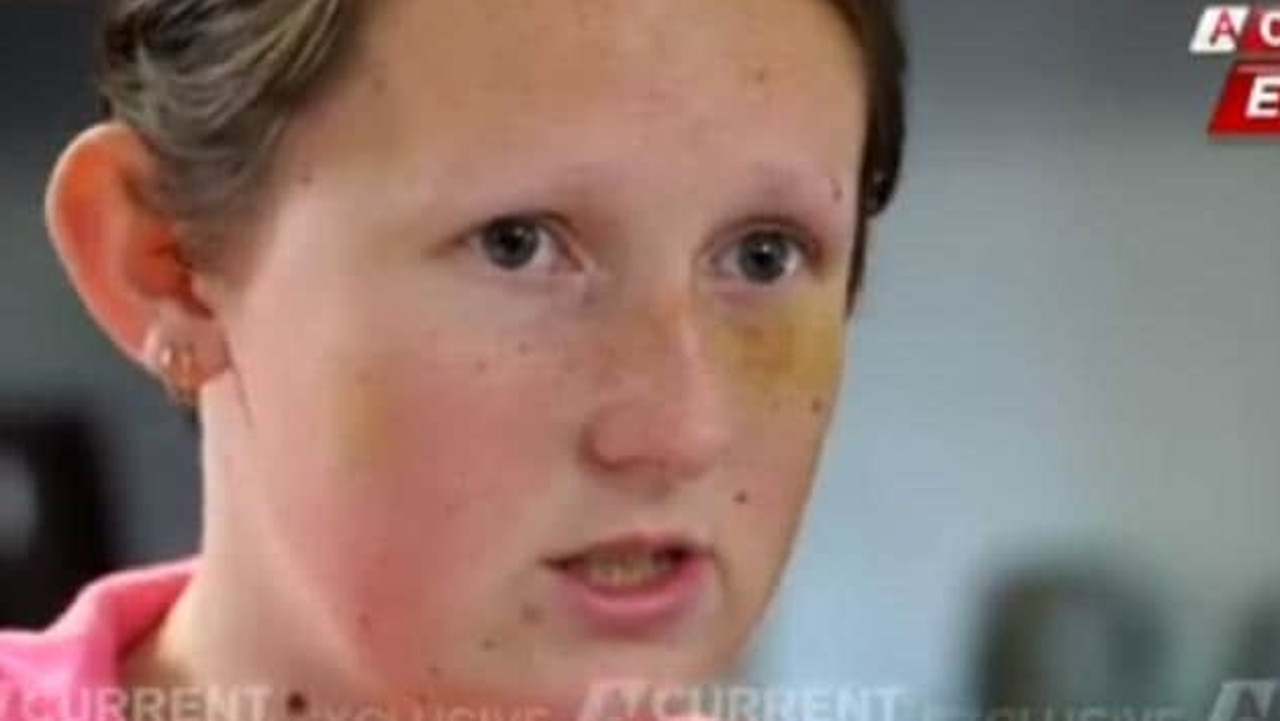 Kayla Kendrigan spoke to A Current Affair about her ordeal.