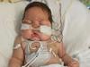 ‘Heartbreaking’: How sniffly nose uncovered newborn’s cancer