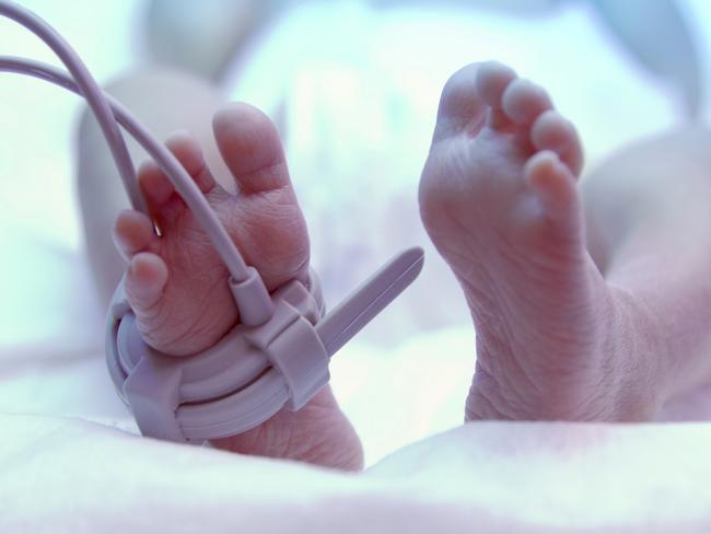 Feet of new born baby under ultraviolet lamp in the incubator. iStock Image - Generic