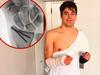 F1 star reveals horror injuries from freak accident