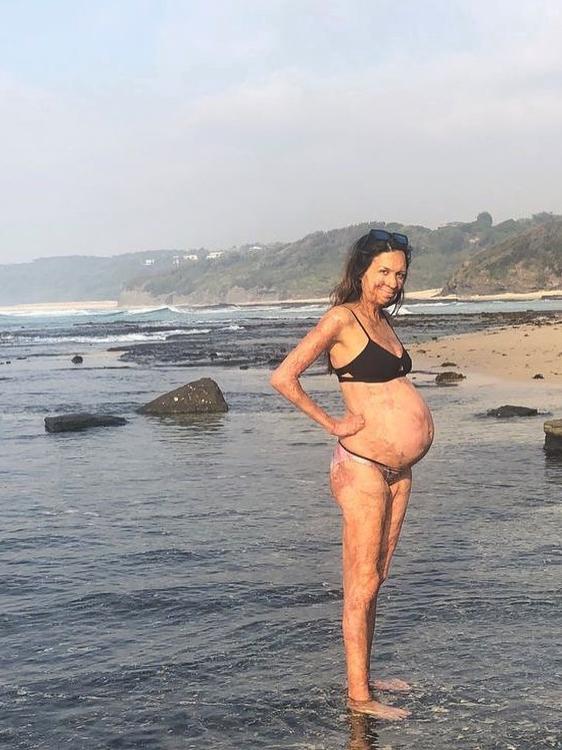 Turia Pitt, pregnant with her second child.