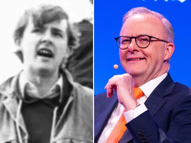 Young and old Anthony Albanese