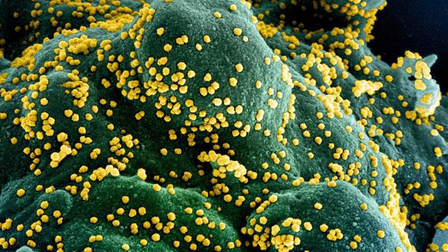 Researchers believe the findings could help create a ‘universal vaccine’. Picture: Handout/National Institute of Allergy and Infectious Diseases/AFP