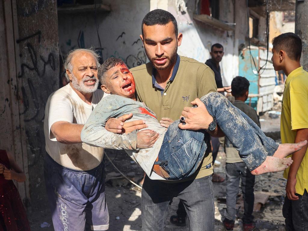 There is still some targeted shelling. A man carries an injured child following Israeli bombardment at al-Bureij refugee camp in the central Gaza Strip. Picture: AFP