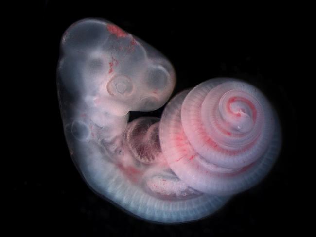 2016 Royal Society Publishing Photography Competition. Picture: Tyler Square. The spiralled snake axis – Runner up: Micro-imaging. During early growth and development, most vertebrate animals look quite similar. Here the 5mm long elongated body of the snake develops as a spiral to fit inside the egg. Boulder, Colorado, USA
