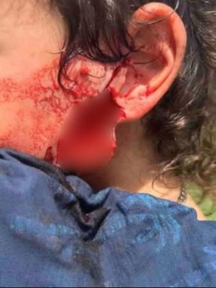 Dante had a large piece of flesh ripped from just below his ear. Picture: 7News