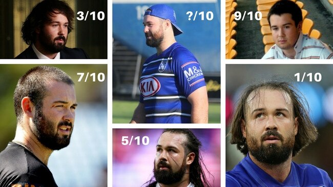 Aaron Woods' many terrible haircuts.