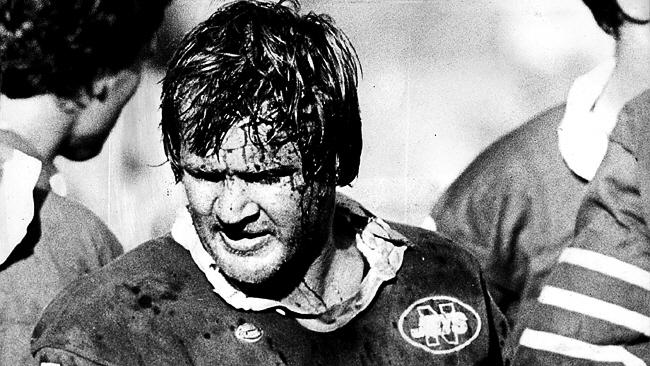 Tommy Raudonikis with blood coming from a head gash during a Newtown v Parramatta game in 1980.