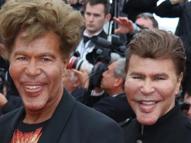 CANNES, FRANCE - MAY 15: (L-R) Igor Bogdanoff and Grichka Bogdanoff attend the screening of "Solo: A Star Wars Story" during the 71st annual Cannes Film Festival at Palais des Festivals on May 15, 2018 in Cannes, France.  (Photo by Tony Barson/FilmMagic)