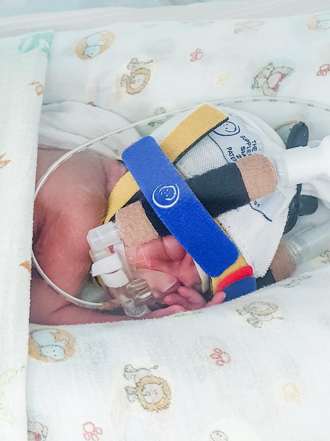 William (972g) was admitted to the neonatal intensive care unit (NICU). Picture: Supplied.