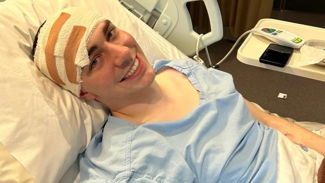 Liam O'Dea receiving treatment after his neurosurgery. Picture: Supplied