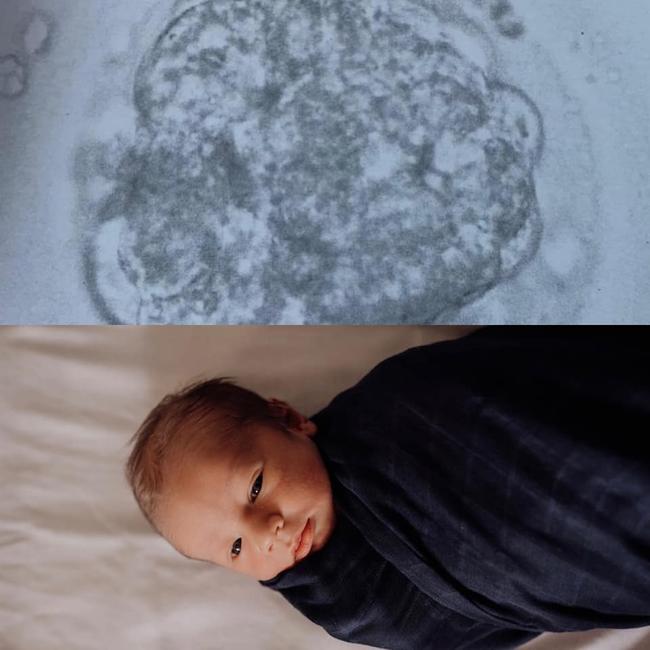 Townsville miracle babies - Dr Mokrzecki helped us conceive through IVF and was absolutely brilliant! We are so lucky to have these amazing specialists in Townsville! Photo: Anna De Wit