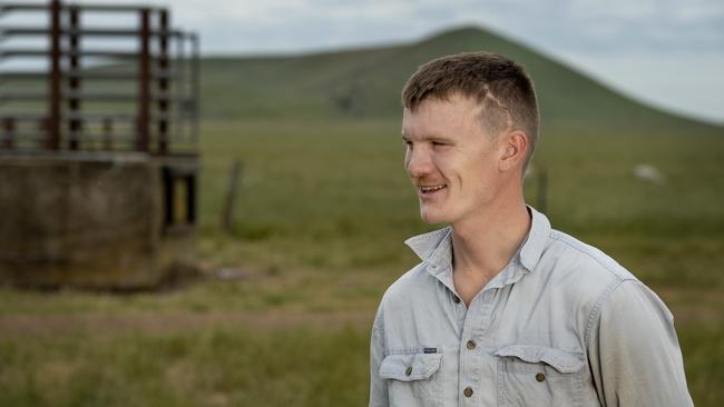 William Cole sports the scar on his head from the motorbike crash that changed his life. Picture: Zoe Phillips