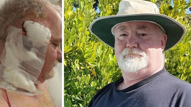 ‘Incredibly lucky’: Man’s horrific cancer battle sparks safety mission