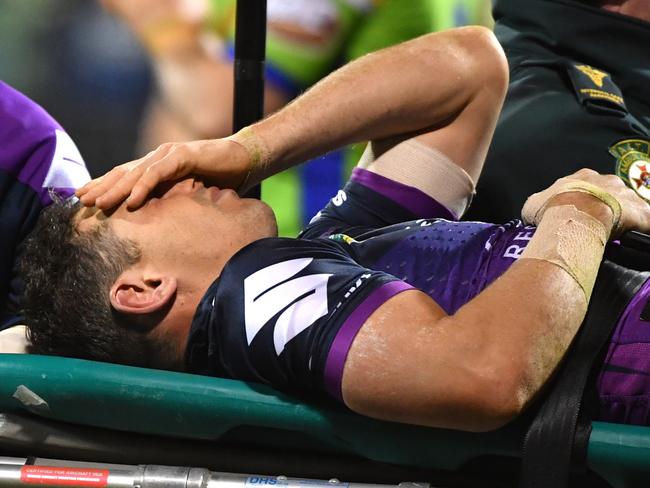 Billy Slater of the Storm is carried off after being knocked out during the Round 20 NRL match between the Canberra Raiders and the Melbourne Storm at GIO Stadium in Canberra, Saturday, July 22, 2017. (AAP Image/Mick Tsikas) NO ARCHIVING, EDITORIAL USE ONLY