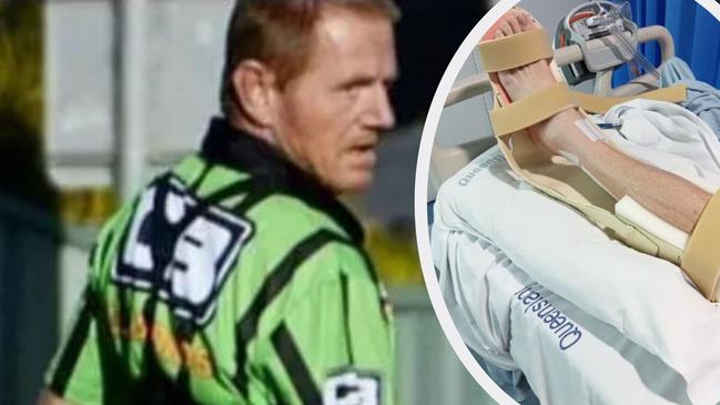 A football referee‘s life took a tragic turn as his ‘harmless’ 35-year-old cyst turned cancerous, jeopardising his leg.