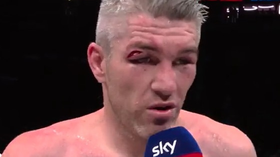 Liam Smith was not in a good way. Photo: Supplied.