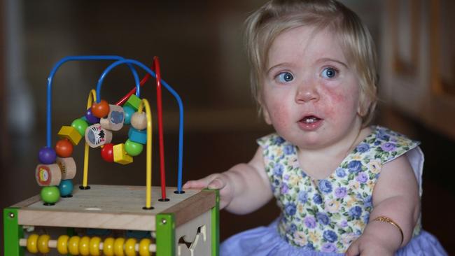 Helena is off with her parents to the United States to get advice on how to treat her breathing difficulties. Picture: Tim Clapin.