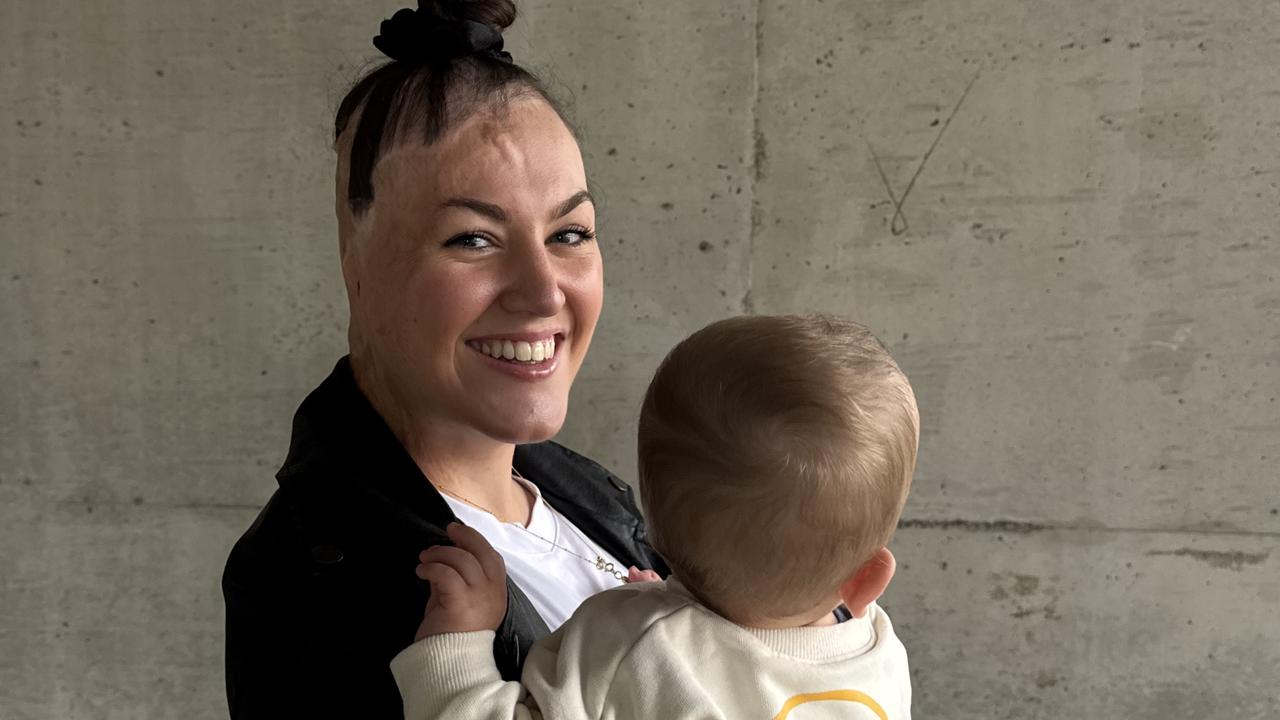 Sophie Delezio opens up on her first Mother’s Day
