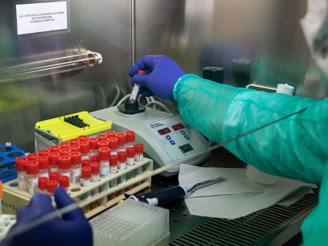 A lab worker tries to isolate the presence of coronavirus during a swab test process in the Molecular biology laboratory in Milan, Italy. Picture: Getty