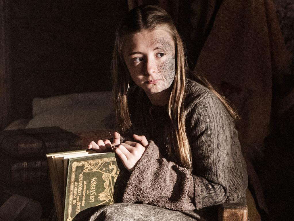 Greyscale, which affected Princess Shireen, is a lot like a real-life disease. Picture: HBO