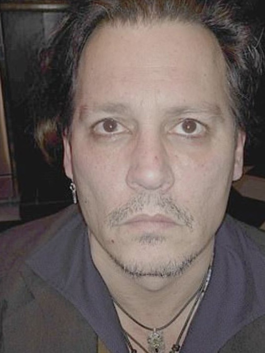 Johnny Depp also provided pictures of his bruised face. Picture: Fairfax County Court