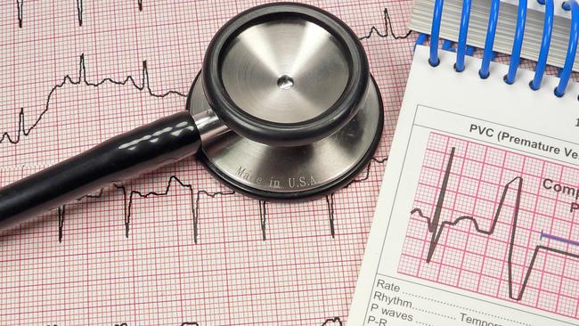 (File image) GPs are concerned the ECG rebate cut, along with others in the past decade, is reducing the number of new grads entering general practice.