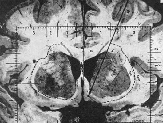 How a scientist tried to ‘cure the gays’