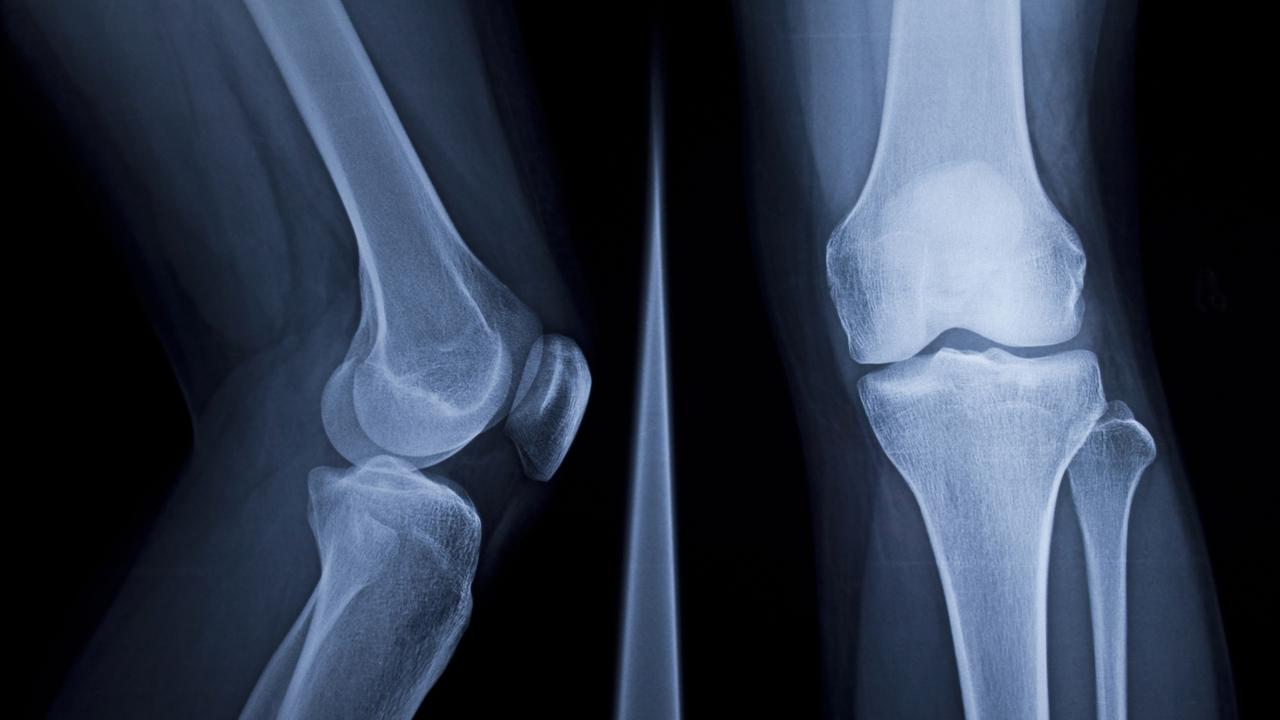 Cancer-care business Icon Group to hit the market