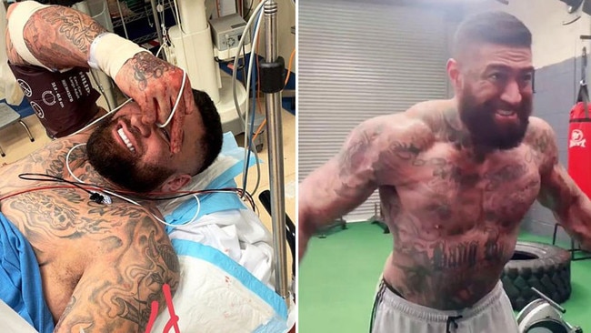 Big Kash on a stretcher at hospital after being shot, left, and now in a TikTok chronicling his workout regime. Pictures: Supplied