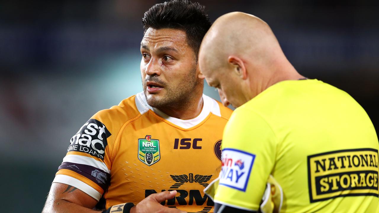 SYDNEY, AUSTRALIA - AUGUST 25: Alex Glenn of the Broncos receives attention from the trainer during the round 24 NRL match between the Sydney Roosters and the Brisbane Broncos at Allianz Stadium on August 25, 2018 in Sydney, Australia. (Photo by Mark Kolbe/Getty Images)