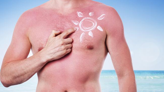 More Australian men need to realise that the lobster impressions are no joke. Picture: Supplied