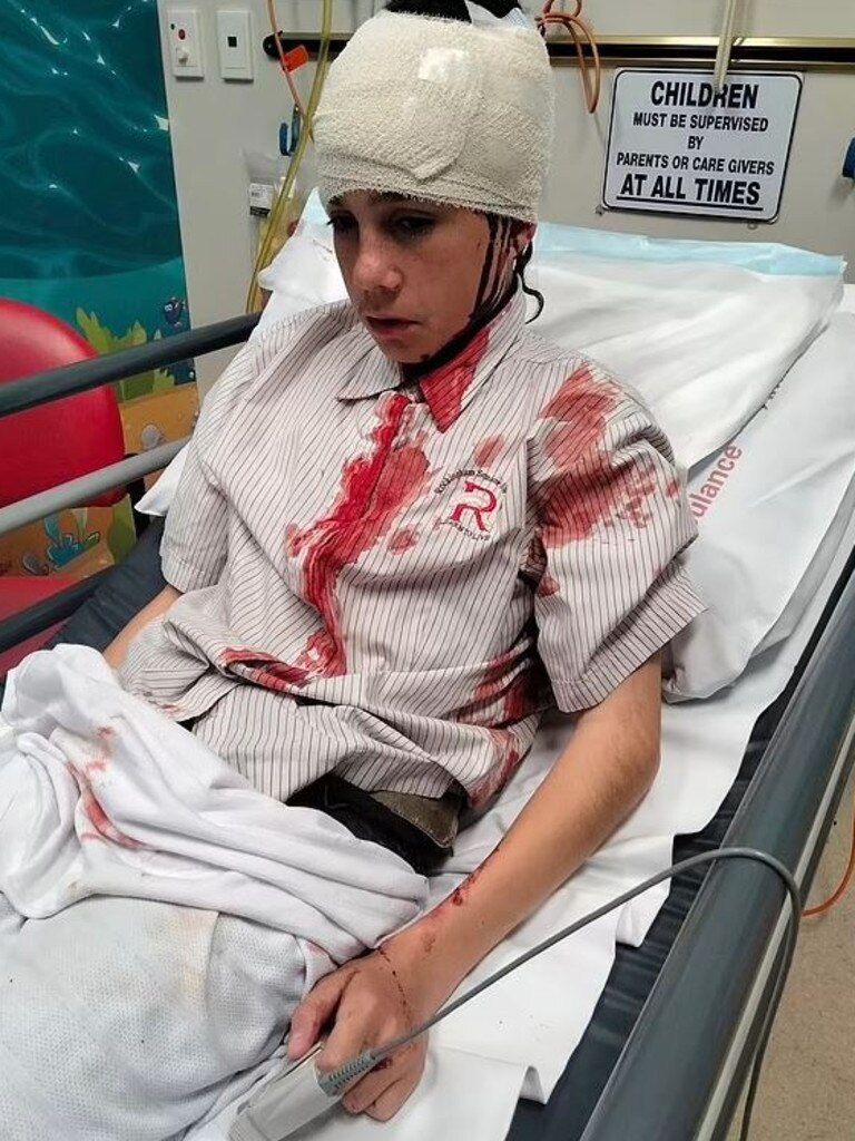 Boston Yarran was ambushed by a group of bullies on his way home from school. Picture: Facebook