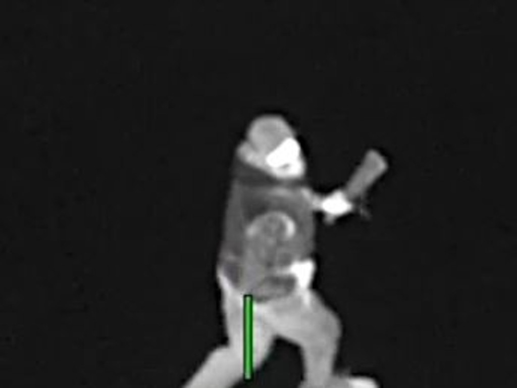 A machete-wielding teen was charged after a group of youth allegedly launched a violent attack on a man in Melbourne's northwest. Picture: Supplied
