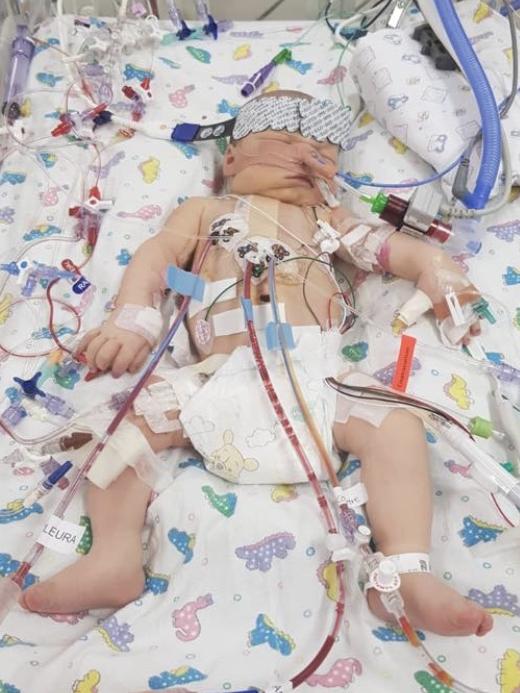 Joshua in intensive care