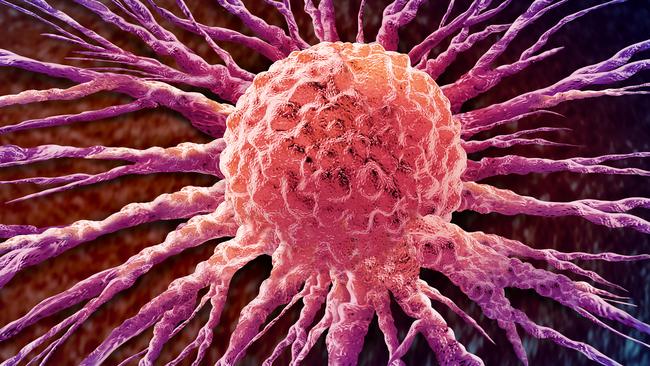 Cancer Cell Spread and oncology or Malignant Cancerous Growth and Metastasis anatomy concept as growing tumor cells and Malignancy disease spreading metastasized on an organ inside the human body as a 3D illustration.