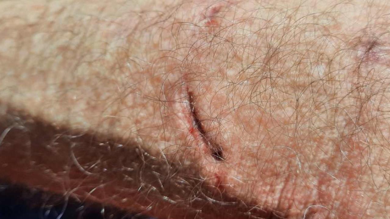 Ergon Energy is pleading with Queensland dog owners to properly restrain their pets after more than 270 attacks in the past two years. Picture: Contributed