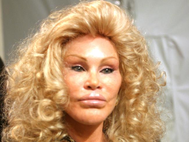 (FILES) Socialite Jocelyn Wildenstein looks on backstage at the Lloyd Klein show during Olympus Fashion Week at the Plaza at Bryant Park Spring 2005 in New York City on September 11, 2004. The Swiss socialite, also known as "catwoman" due to her extensive plastic surgery, has died aged 79, her partner said on January 1, 2025. "Her partner Lloyd Klein is pained to announce the death of Jocelyn Wildenstein in Paris aged 79" he told AFP in a statement. (Photo by Astrid Stawiarz / Getty Images North America / AFP)