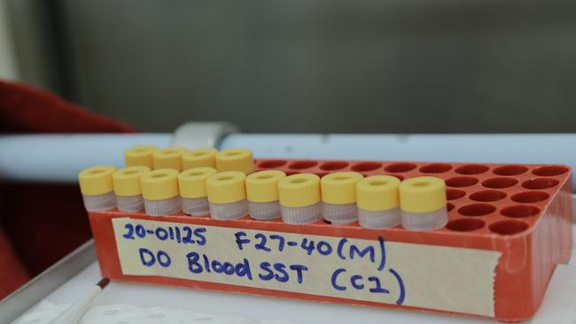 The CSIRO is testing the COVID-19 vaccine candidates for efficacy at its Australian Animal Health Laboratory in Geelong.