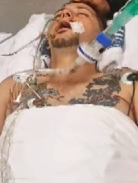 Supplied Editorial Adam Whetstone was left with serious injuries after an assault last month. Picture: 9 News